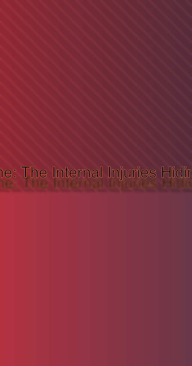 Seat Belt Syndrome: The Internal Injuries Hiding Behind a Bruise